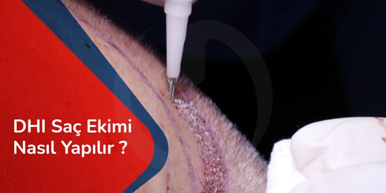 DHI Saç Ekimi Nasıl Yapılır?